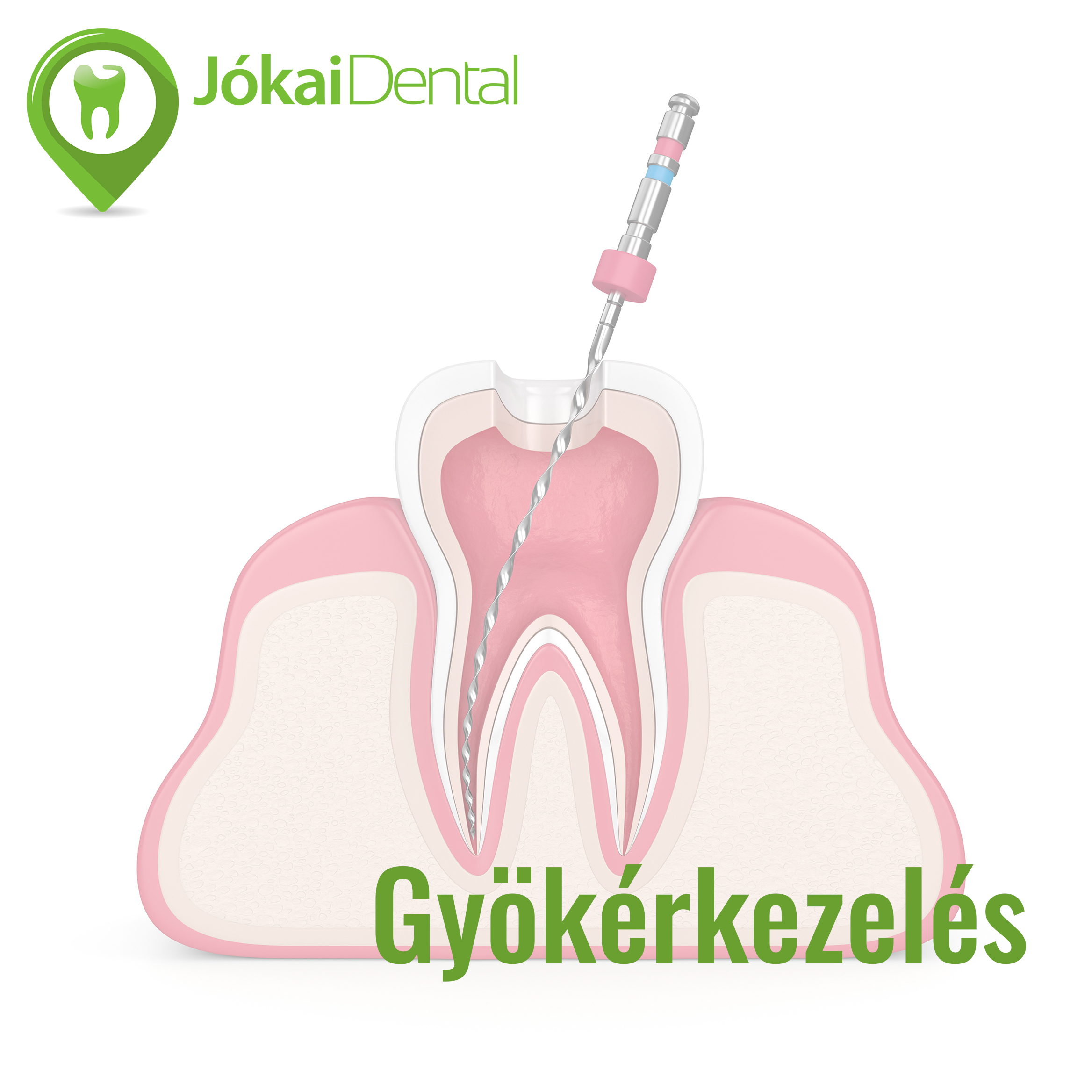 Gy k rkezel s J kai Dental fogorvosi rendel Budapesten